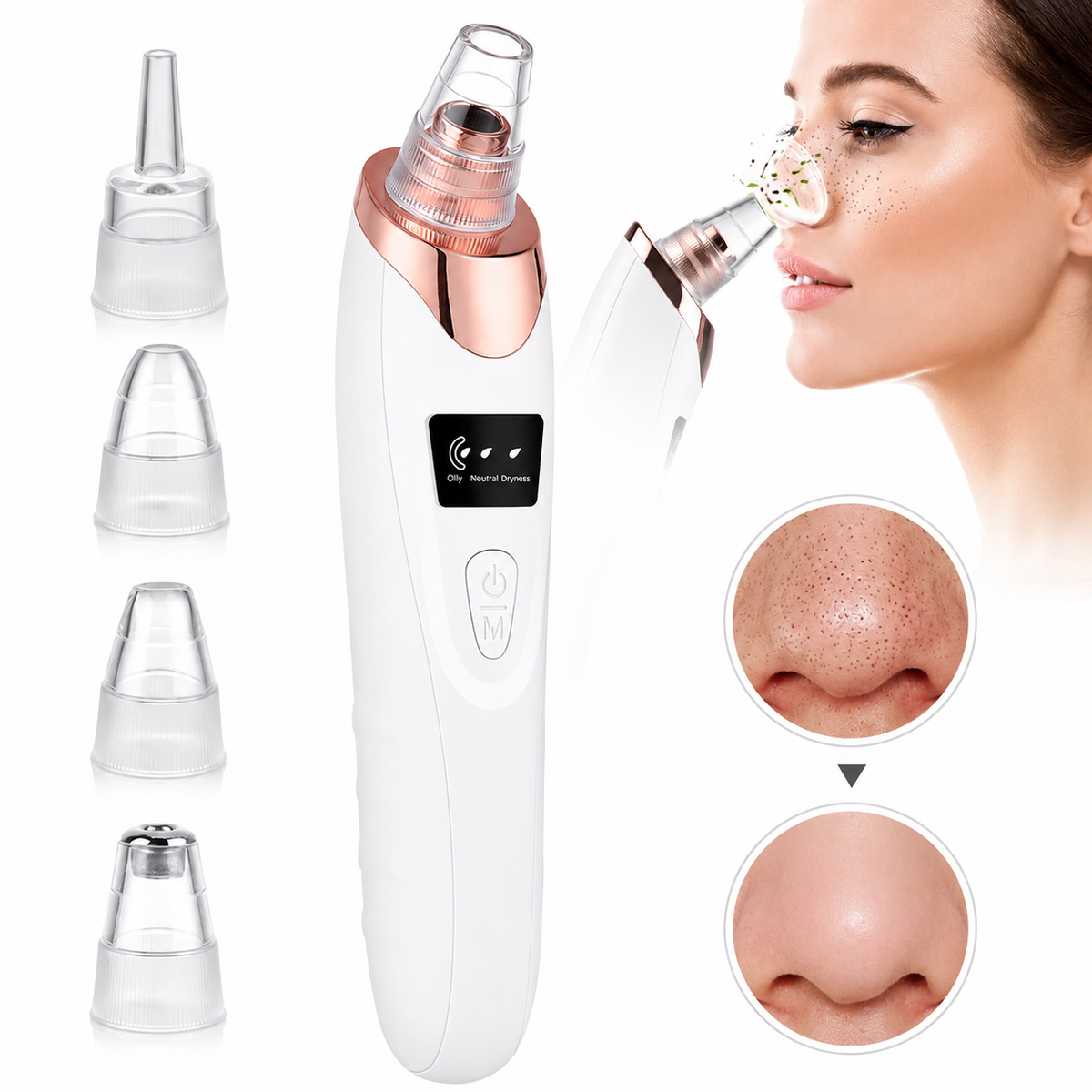 5-in-1 Electric Blackhead Remover & Pore Cleaner